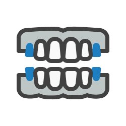 Dental Bridges