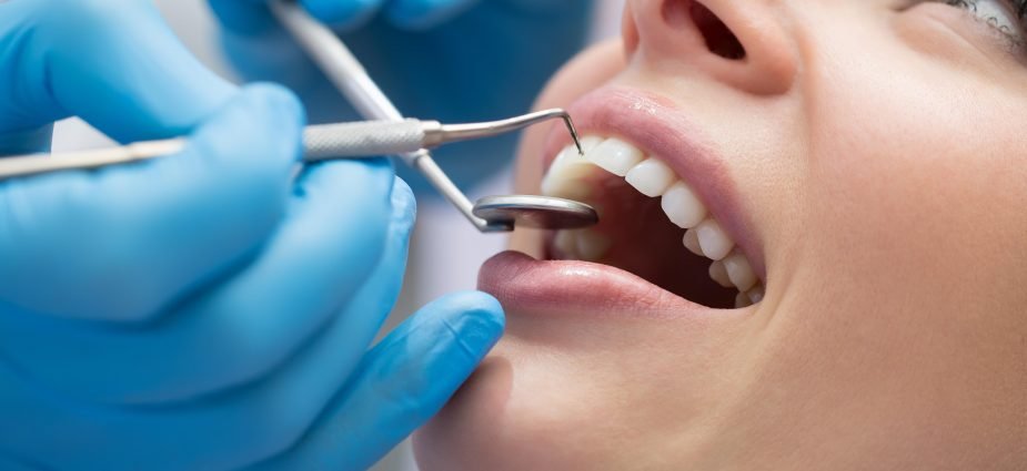 dental implants at All Smile BDS Blacktown
